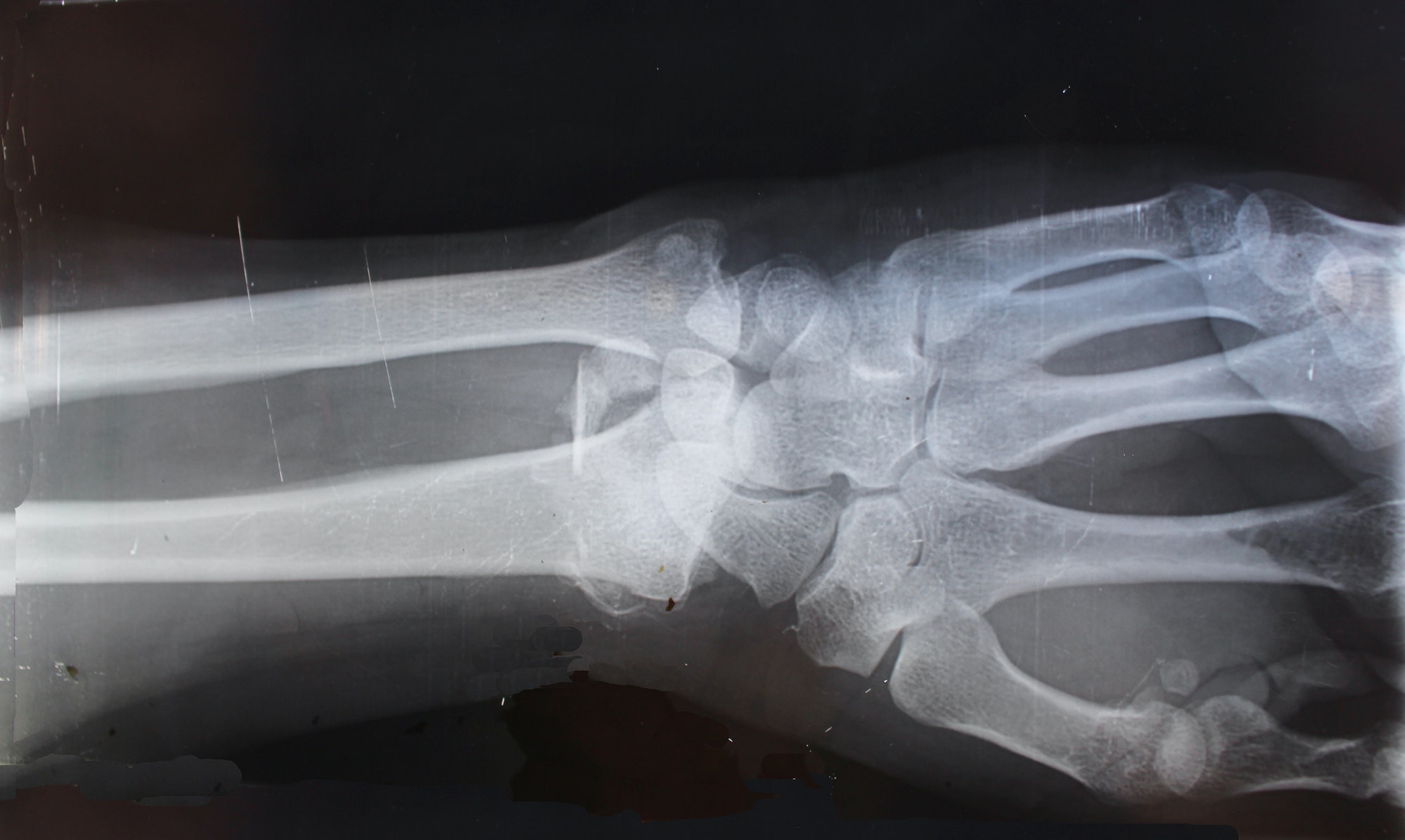 Trasparenza ai raggi X e nel visibile: innovativo tavolo per radiografie